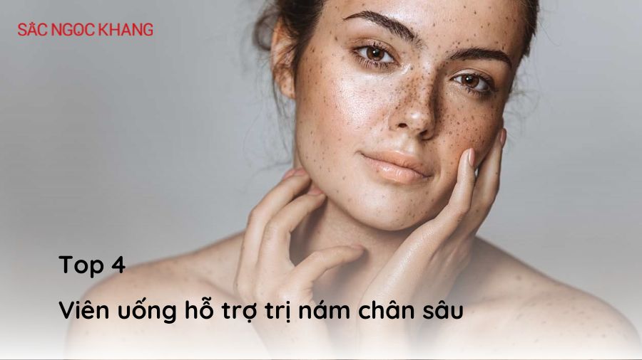 viên uống hỗ trợ trị nám chân sâu được tin dùng