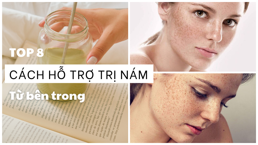 cách hỗ trợ trị nám từ bên trong an toàn, hiệu quả