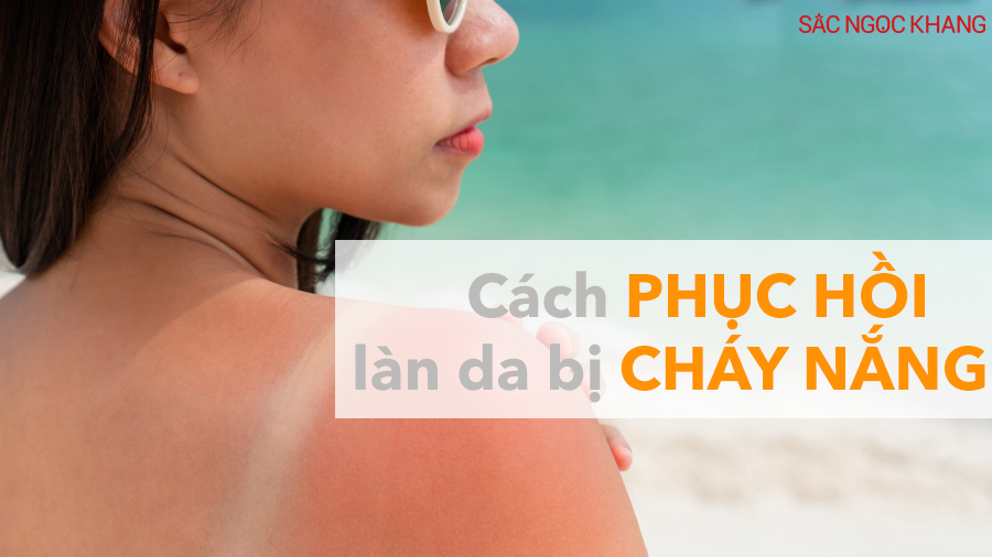 Bí quyết phục hồi da cháy nắng tại nhà cực kỳ hiệu quả
