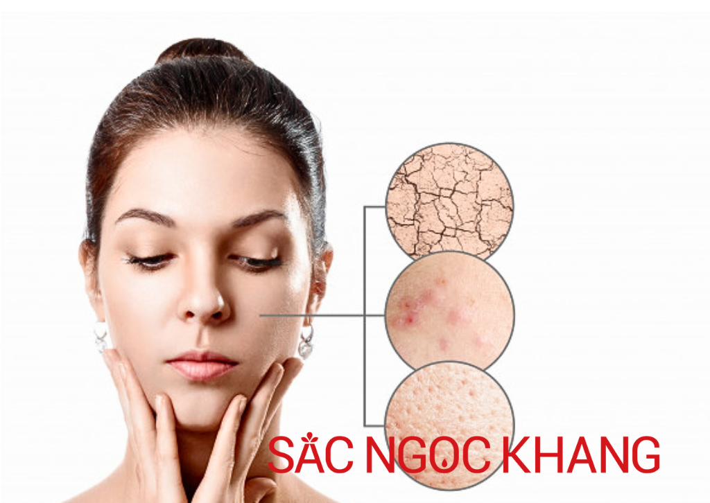 Dấu Hiệu Da Mất Cân Bằng PH