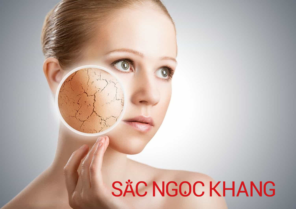 Dấu Hiệu Da Mất Cân Bằng PH