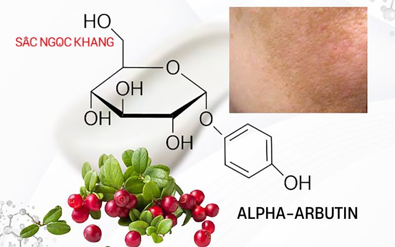alpha arbutin