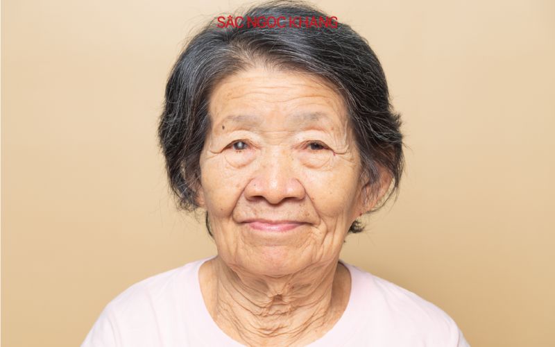 Bệnh đục thủy tinh thể