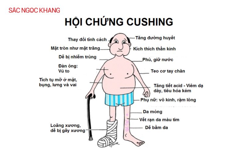 Các bệnh nội tiết thường gặp
