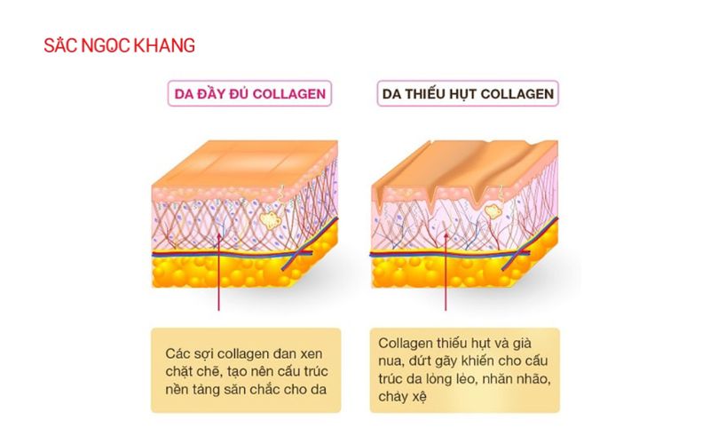 Các loại collagen tốt nhất hiện nay