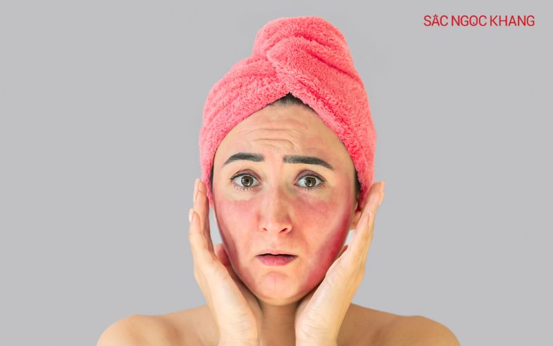 Da nhạy cảm dễ bị kích ứng bởi hương liệu, cồn, chất bảo quản