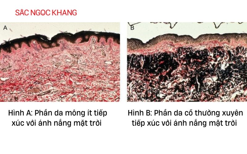 elastin