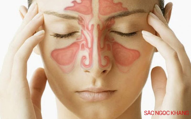 cổ họng lúc nào cũng có đờm là bệnh gì