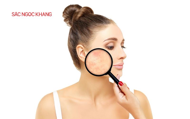 Mật ong lên men giúp giảm thiểu nguy cơ kích ứng da