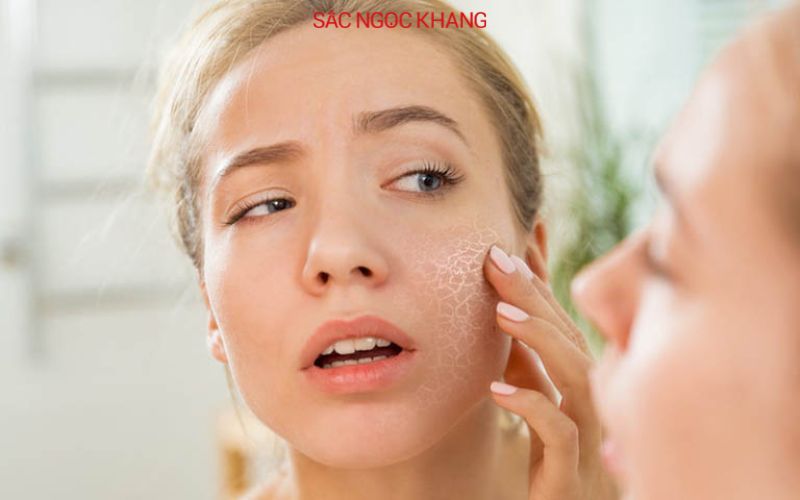 Thời tiêt thay đổi khiến da khô sần