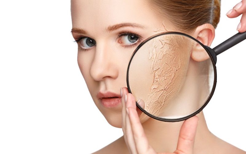 Da nhạy cảm là dấu hiệu cho thấy làn da đang nhiễm độc tố