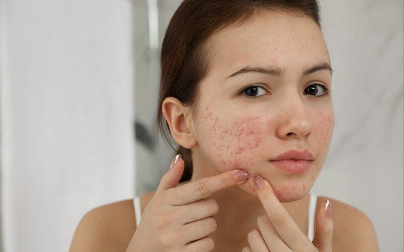 Một số độc tố có thể gây kích ứng da