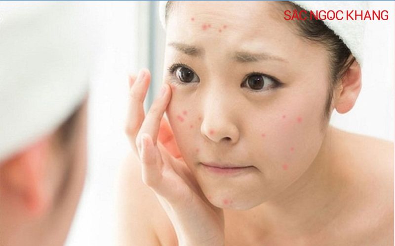 Dầu jojoba có tác dụng gì