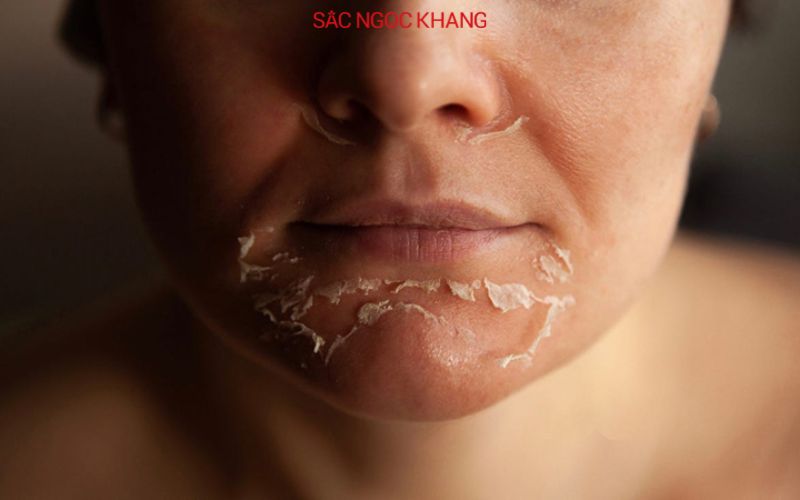 Cấu trúc của da