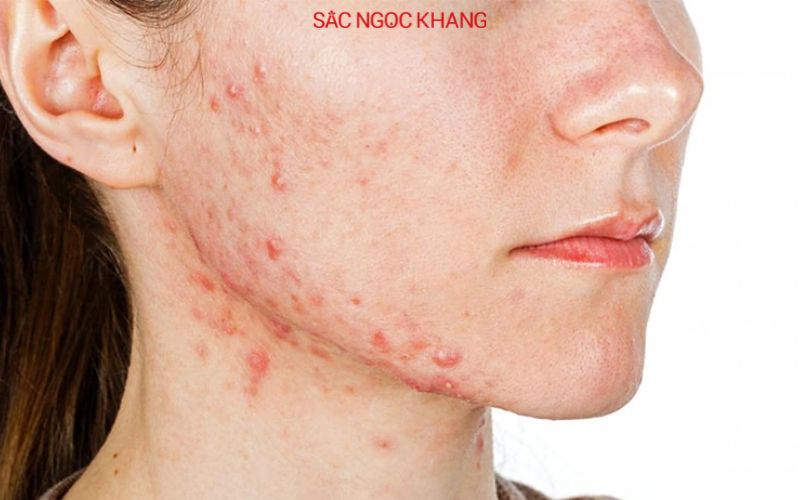 Cấu trúc của da