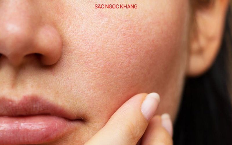 Chọn tẩy trang có khả năng cung cấp độ ẩm cho da khô