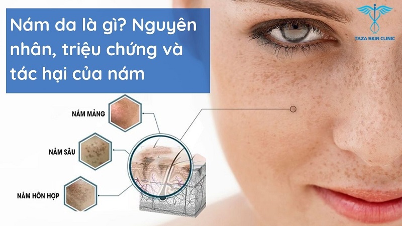 nám da