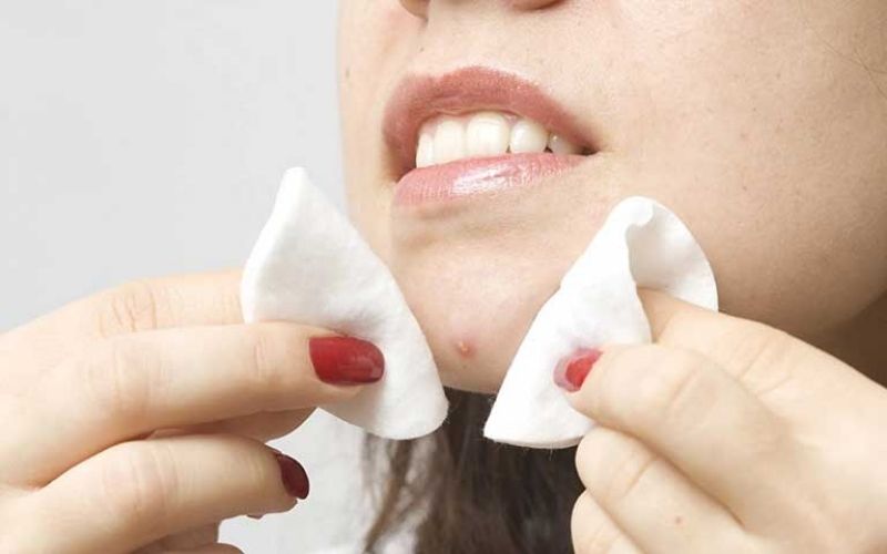 Thông tin về mụn đinh râu