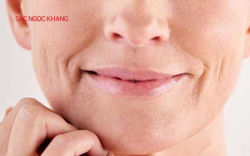 Nếp nhăn khoé miệng khiến tổng thể gương mặt trông già nua