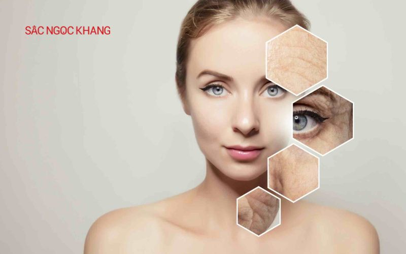 Quá trình lão hóa tự nhiên gây nếp nhăn quanh miệng