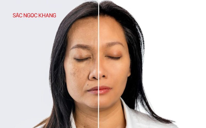 Tuổi càng cao thì các nếp nhăn sẽ càng lộ rõ