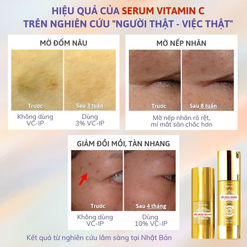 serum dưỡng trắng da serum dưỡng trắng da