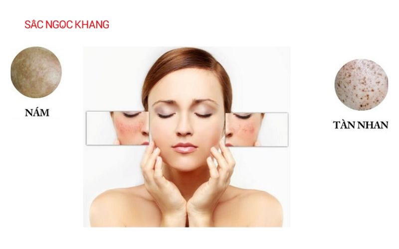 Viên uống hỗ trợ trị nám tàn nhang