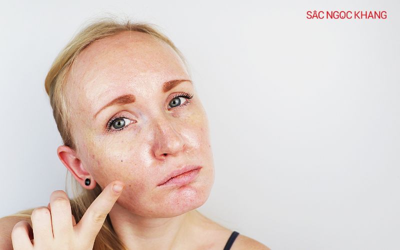 Da dầu sử dụng các sản phẩm tẩy tế bào chết dạng gel hoặc scrub có chứa BHA