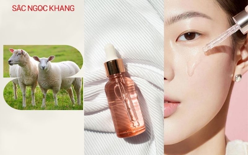 Serum nhau thai cừu