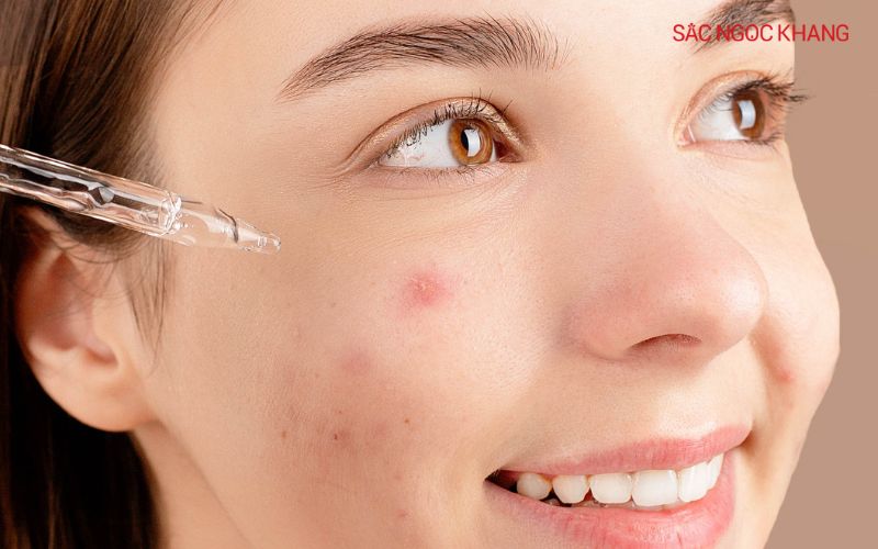 Thoa đều serum lên vùng da bị mụn hoặc toàn bộ khuôn mặt