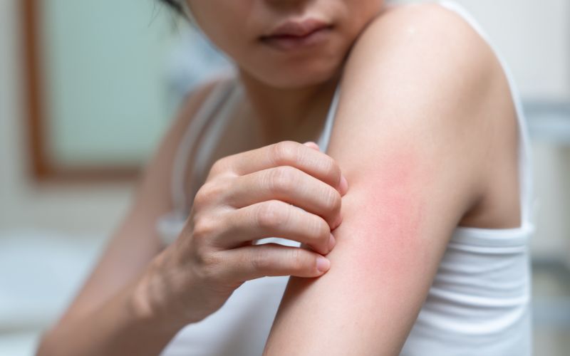 Nên chọn sản phẩm có thành phần dịu nhẹ, chiết xuất từ thiên nhiên cho da nhạy cảm