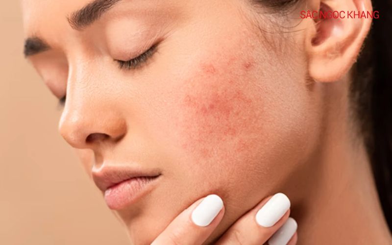 Collagen collagen giúp phục hồi và tái tạo làn da tổn thương
