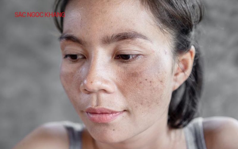 Viên uống đẹp da của Nhật