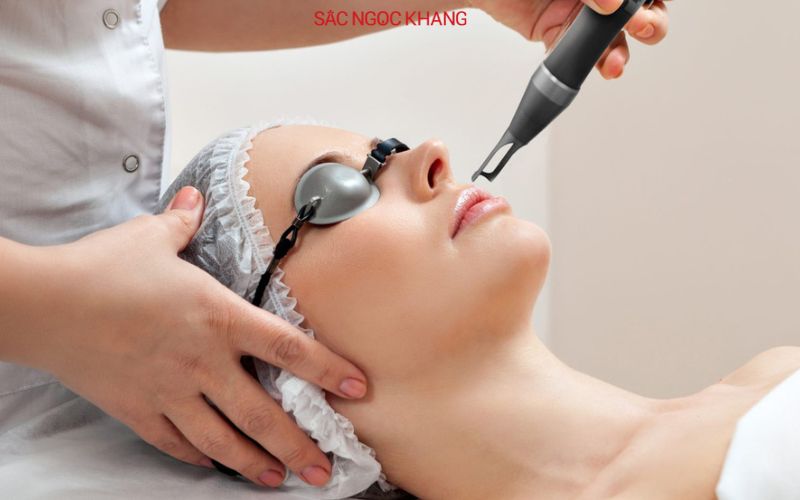 trị nám tàn nhang