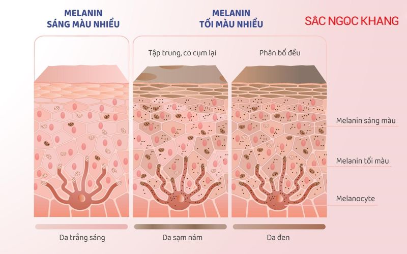 uống gì giảm sắc tố melanin