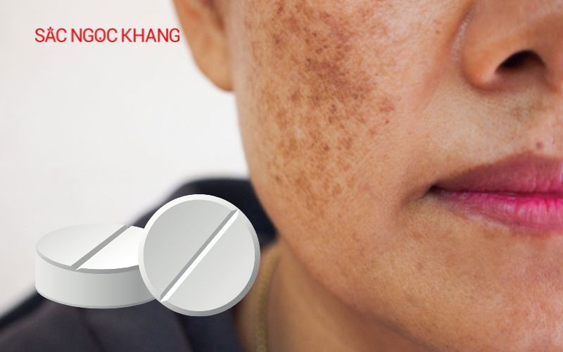 Viên uống hỗ trợ trị nám Hàn Quốc 