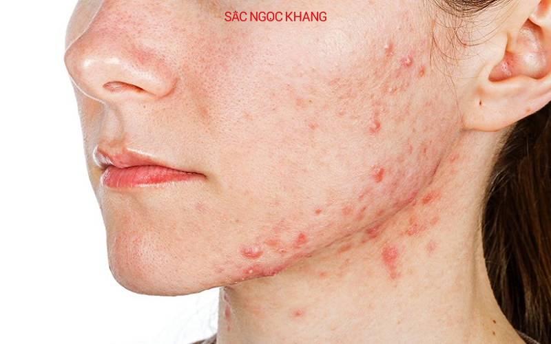 Vitamin b3 có tác dụng gì với da